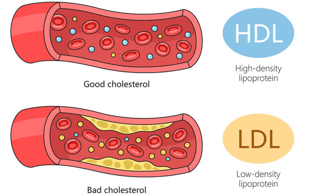 How to Lower Cholesterol Naturally
