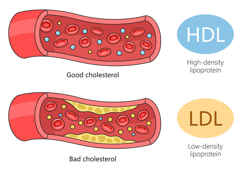 How to Lower Cholesterol Naturally